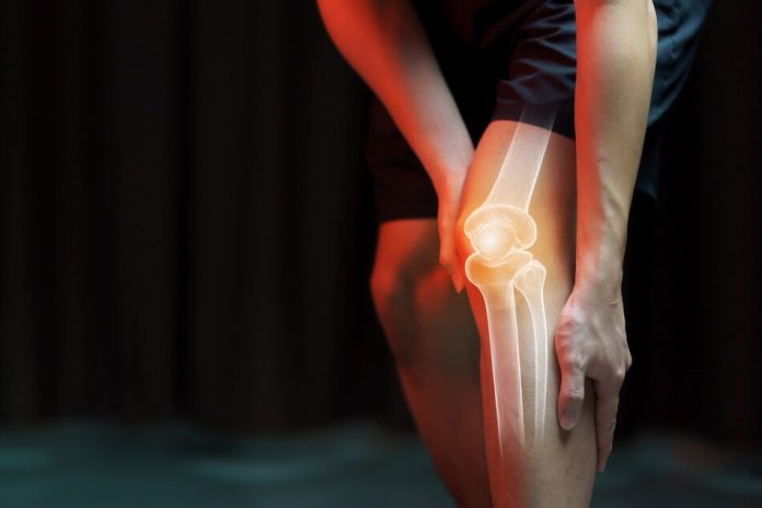 10 Natural Ways To Improve Bone Health And Strengthen Your Skeleton